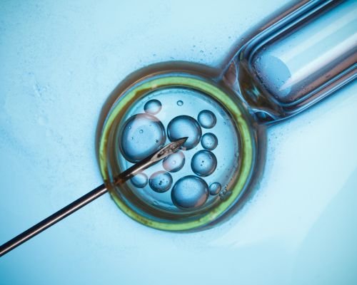 Failed IUI IVF Treatments