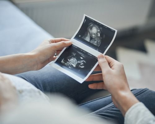 Recurrent Miscarriages